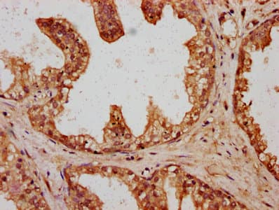 Polyclonal Rabbit anti-Human HT036 / HYI Antibody (IHC)