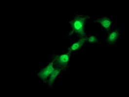 TMOD1 / Tropomodulin 1 Antibody (clone OTI4G9)
