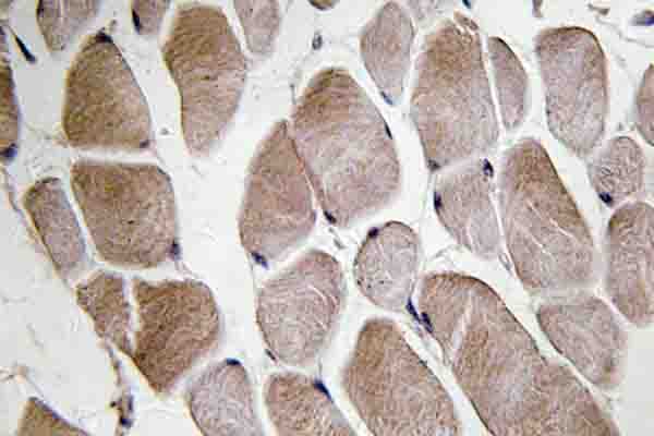 NMU / Neuromedin U Antibody (Ile174)