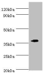 Polyclonal Rabbit anti-Human EFNB2 / Ephrin B2 Antibody (aa28-229, IHC, WB)