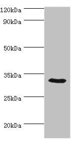 Polyclonal Rabbit anti-Human CA8 / Carbonic Anhydrase VIII Antibody (aa1-290, IHC, WB)
