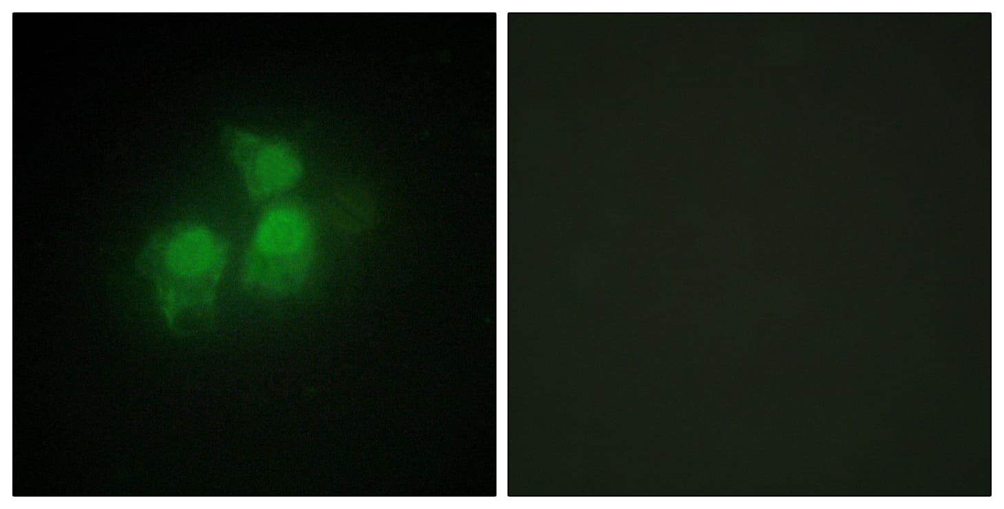IPPK Antibody (aa11-60)
