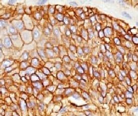 EGFR Antibody (clone ERB59-1)
