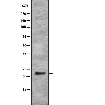 RAB35 Antibody