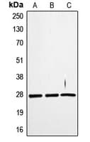 TNFSF12 / TWEAK Antibody (Internal)