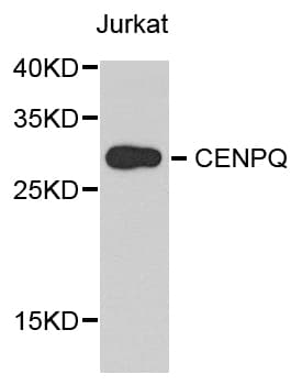 CENPQ Antibody