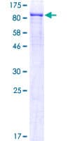 Human TEM1 / CD248 Protein (Recombinant GST)