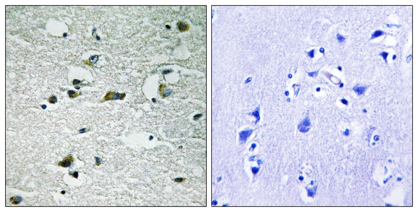 CKI-Gamma 1+2+3 Antibody (phospho-Tyr263)