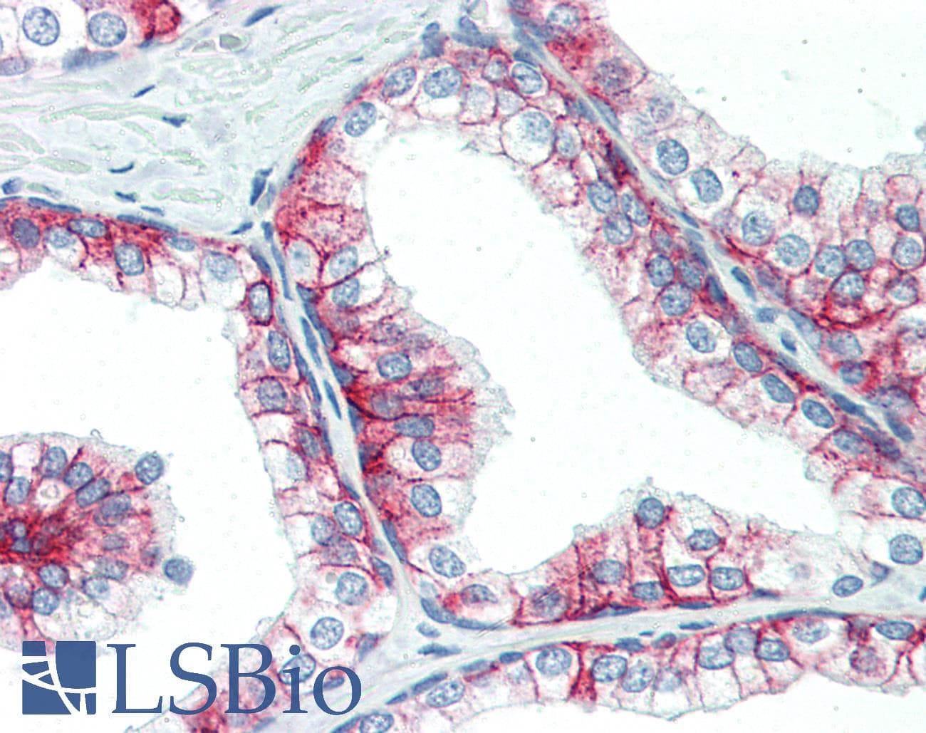 IHC-plus™ Monoclonal Mouse anti-Human Basigin / Emmprin / CD147 Antibody (clone MEM-M6/6, Azide-free, IHC)
