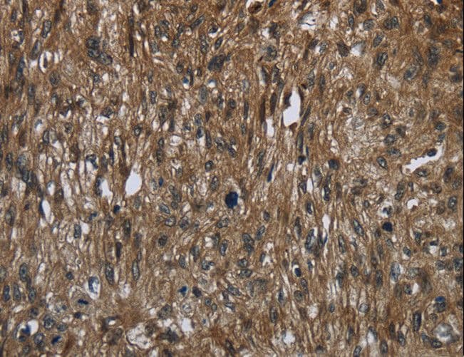 FASTKD2 Antibody