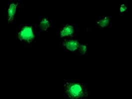 TMPRSS5 Antibody (clone OTI7C3)