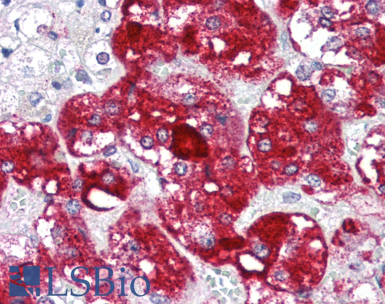 IHC-plus™ Polyclonal Rabbit anti-Human BIRC5 / Survivin Antibody (C-Terminus, IHC)