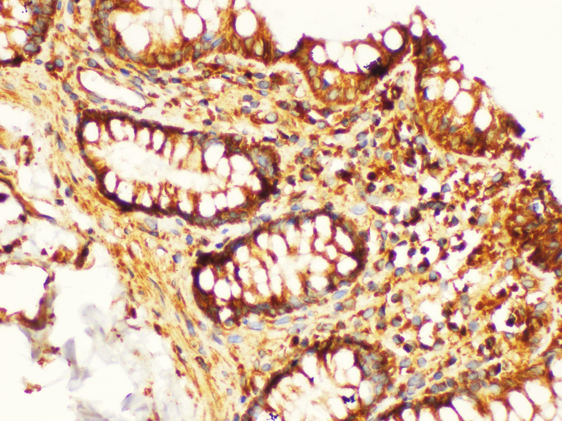 KLK6 / Kallikrein 6 Antibody