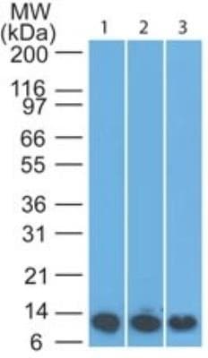 S100A8 / MRP8 Antibody (aa2-98, clone 63N13G5)