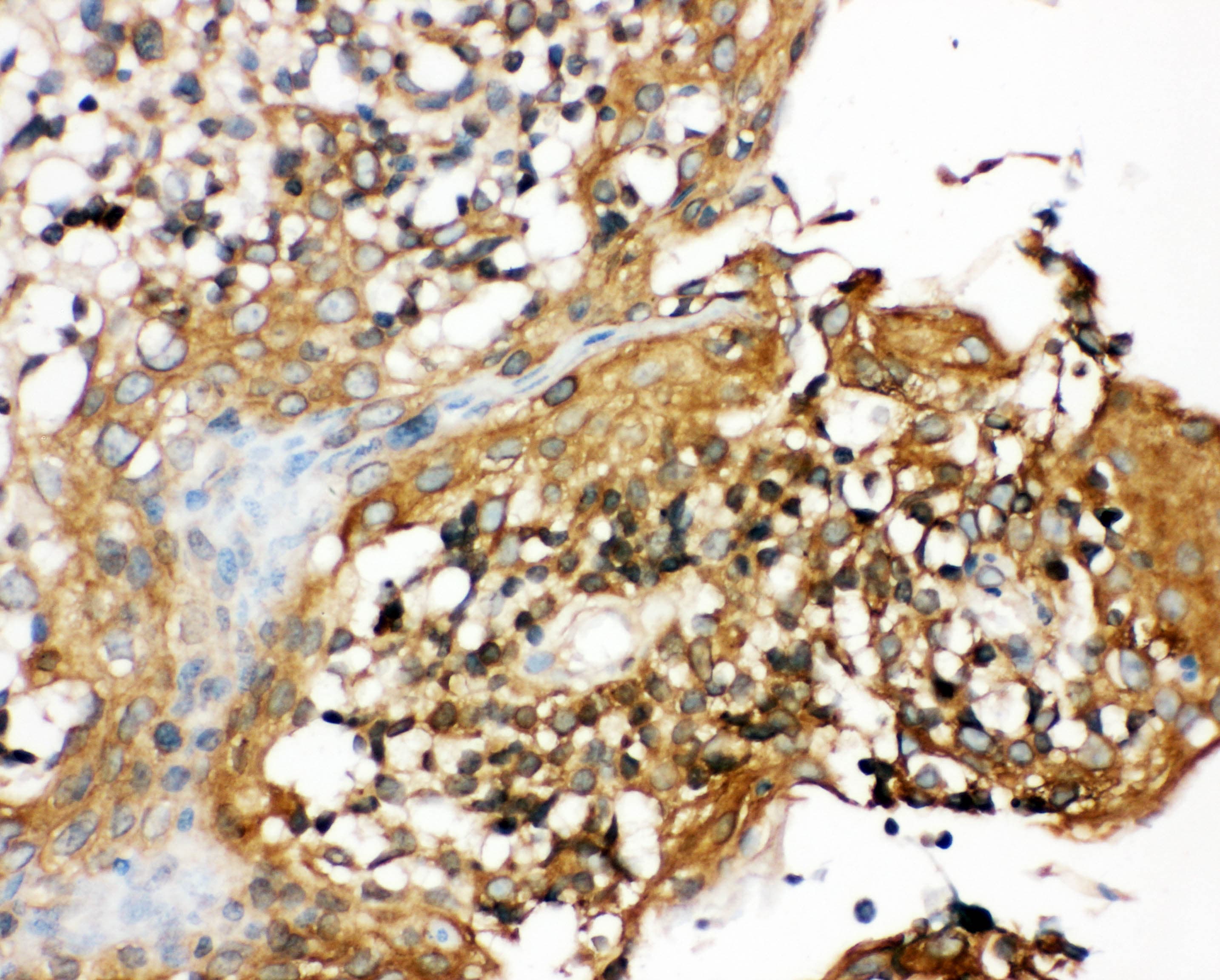 NALP3 / NLRP3 Antibody (aa12-31)
