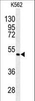 ARP5 / ANGPTL6 Antibody (aa206-236)