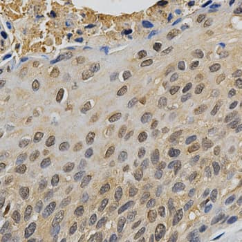 Polyclonal Rabbit anti-Human MAPK10 / JNK3 Antibody (IHC, WB)