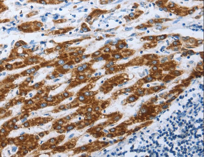 AIFM1 / AIF / PDCD8 Antibody
