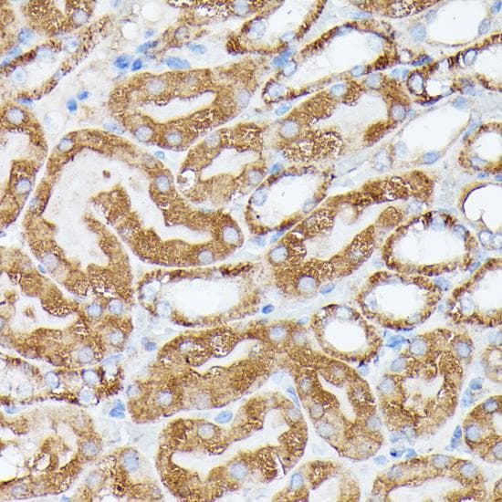 Polyclonal Rabbit anti-Human NBP / NUBP1 Antibody (IHC)