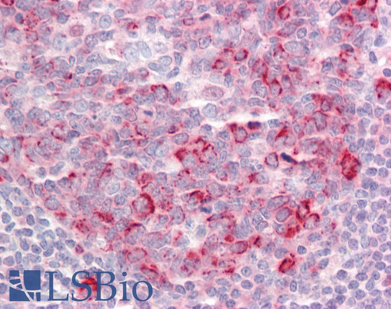 IHC-plus™ Polyclonal Rabbit anti-Human TSHZ1 Antibody (IHC, IF, WB)