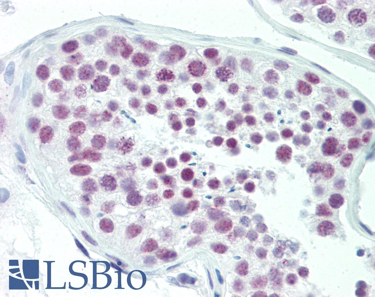 IHC-plus™ DAT1 / LMO3 Antibody (aa96-145)