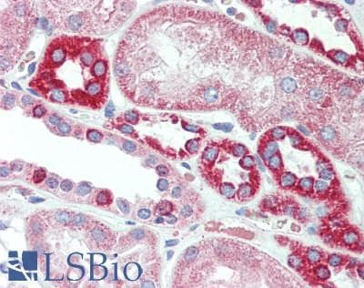 IHC-plus™ CCL17 / TARC Antibody