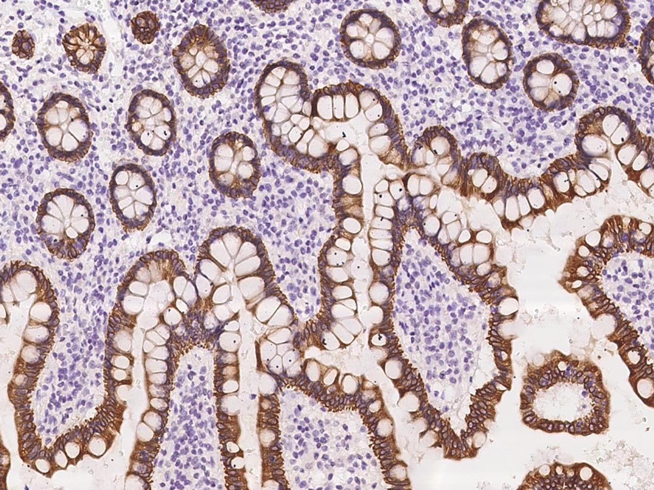 KRT8 / CK8 / Cytokeratin 8 Antibody (Preservative Free)