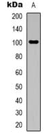 ACO1 / Aconitase Antibody (N-Terminus)
