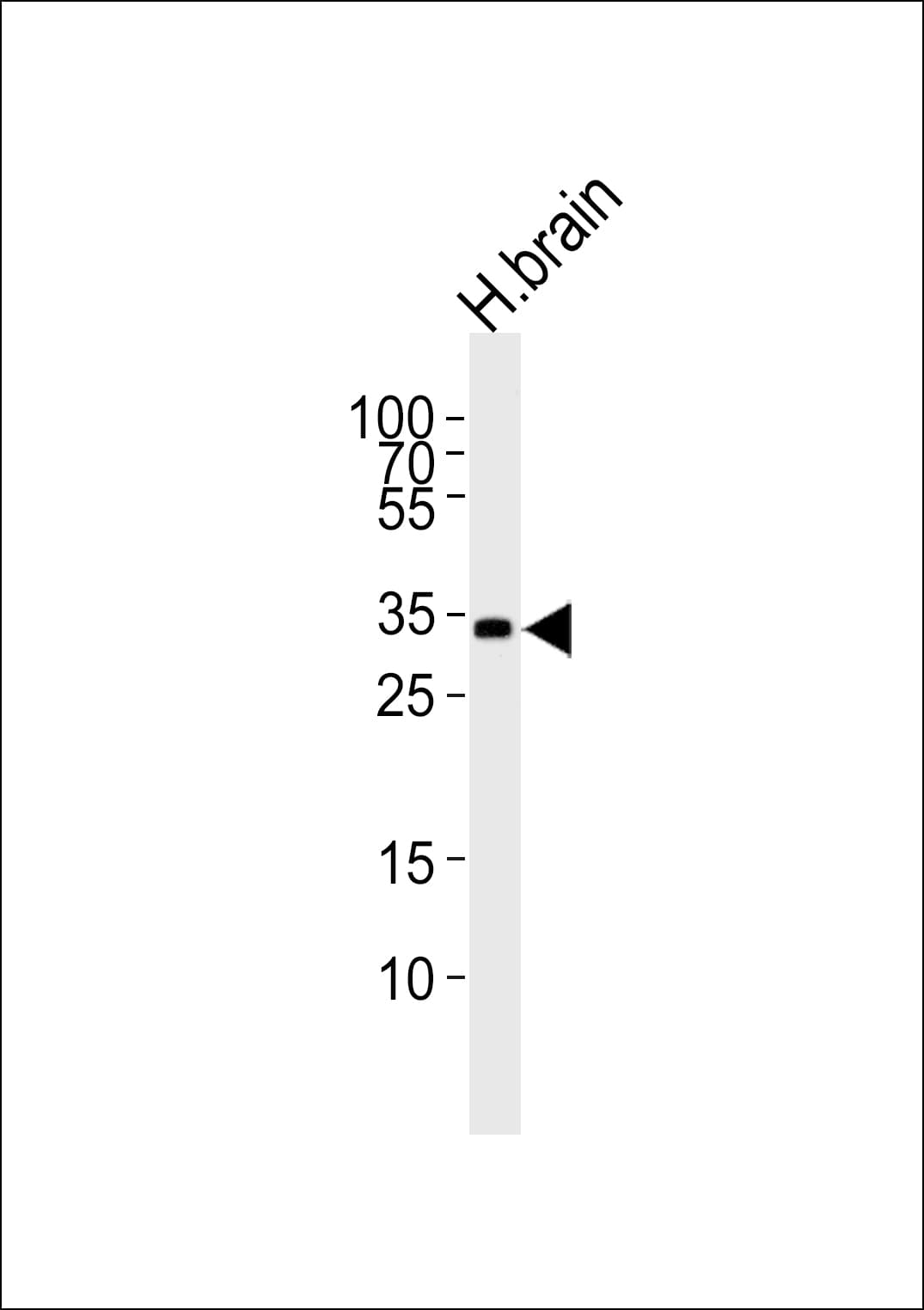 STMN4 / RB3 Antibody (aa34-63)