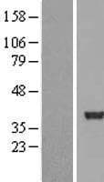 SERTAD2 Protein (Over-Expression Lysate Myc-DDK (Flag))