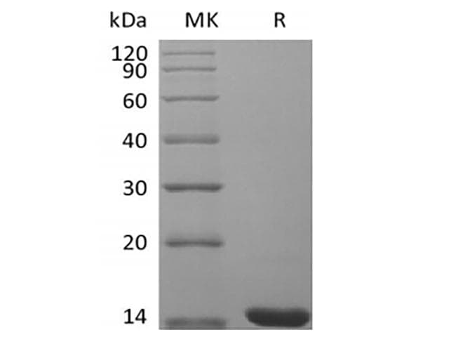 Mouse FGF4 Protein (Recombinant)
