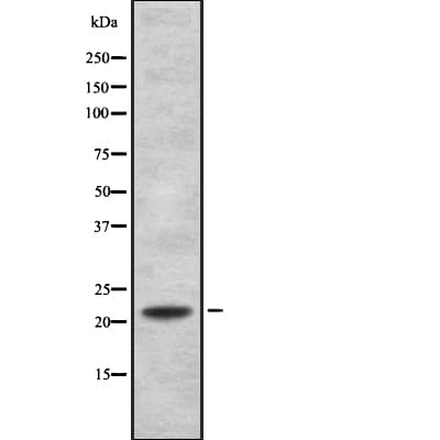 FGF21 Antibody