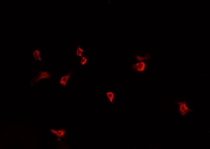 F2 / Prothrombin / Thrombin Antibody