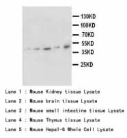 KRT19 / CK19 / Cytokeratin 19 Antibody (aa379-392)