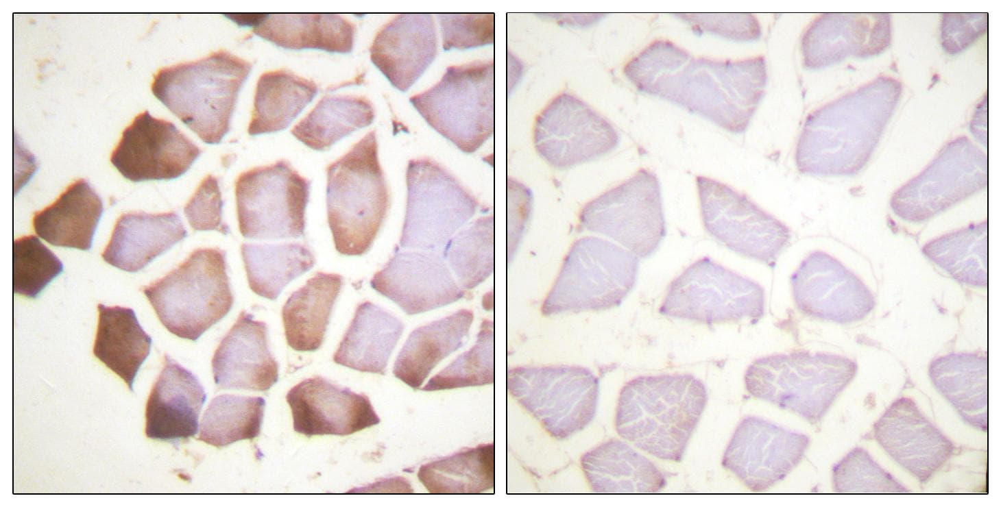 TNNI3 / Cardiac Troponin I Antibody (p22/23)