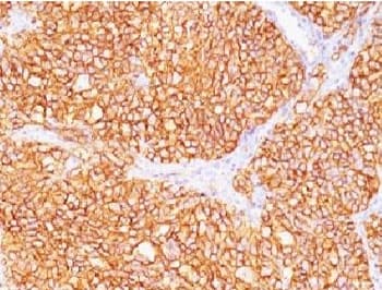 CA9 / Carbonic Anhydrase IX Antibody (clone CBAD9-1)