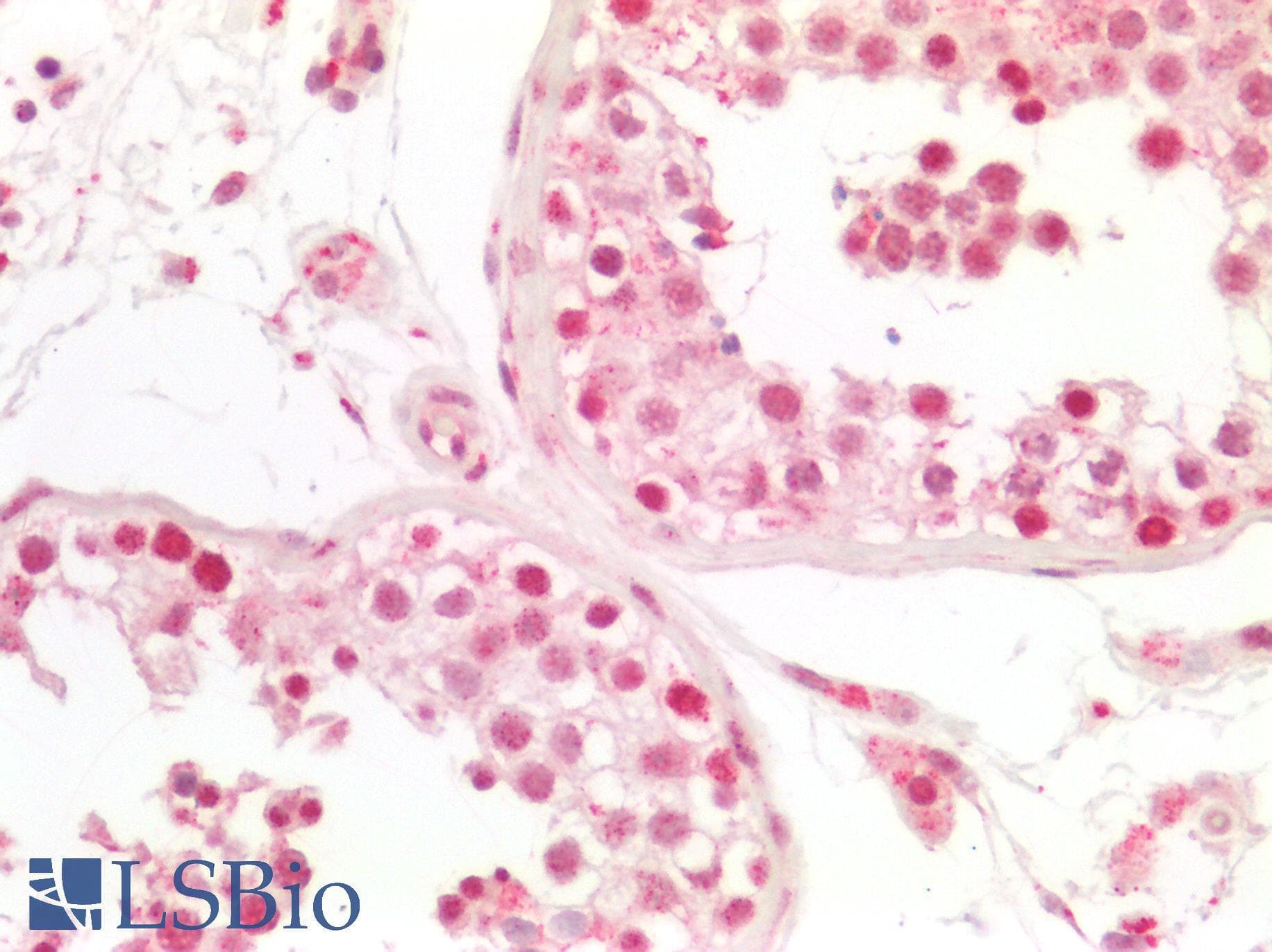 PathPlus™ RB1 / Retinoblastoma / RB Antibody (aa552-601)