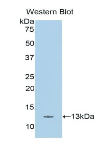 STAT5A Antibody (aa673-773)