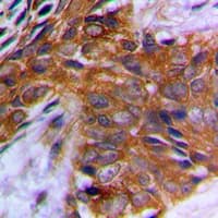 PAK1 Antibody (phospho-Thr212)