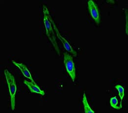 Polyclonal Rabbit anti-Human PRMT4 / CARM1 Antibody (IHC, IF, WB)