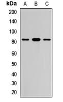 Polyclonal Rabbit anti-Human FCRL3 Antibody (WB)