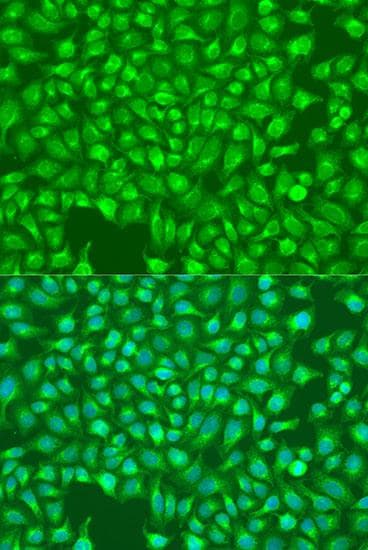 ITPR1 / IP3 Receptor Type 1 Antibody