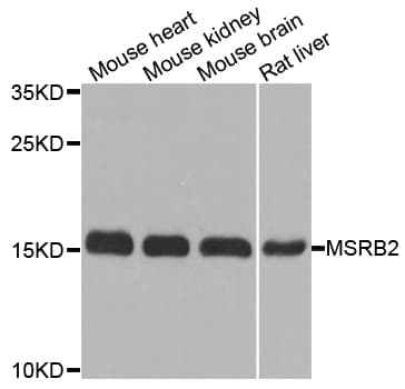Polyclonal Rabbit anti-Human MSRB2 / MSRB Antibody (IHC, WB)