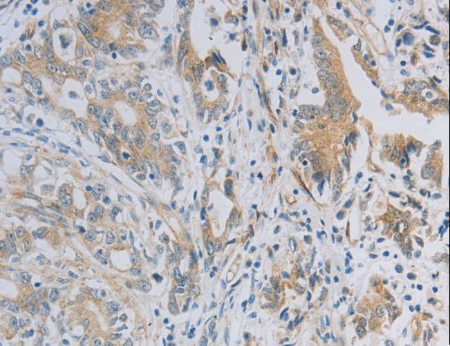 NBN / Nibrin Antibody