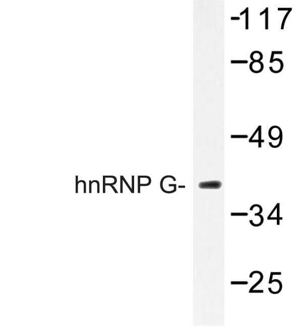 RBMX Antibody (Met40)