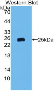 FTH1 / Ferritin Heavy Chain Antibody (aa1-183)