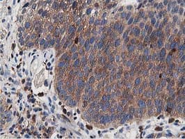Monoclonal Mouse anti-Human ATG3 Antibody (clone OTI2C12, IHC, IF, WB)