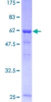 Human STRAP / MAWD Protein (Recombinant GST)