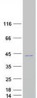 Human OTUD6B Protein (Recombinant Myc-DDK (Flag))