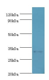 SLC25A15 / ORNT1 Antibody (aa1-301)